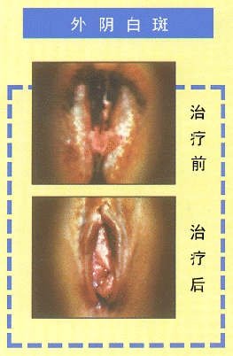 baiban.GIF (67250 bytes)