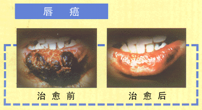 chun.GIF (44880 bytes)